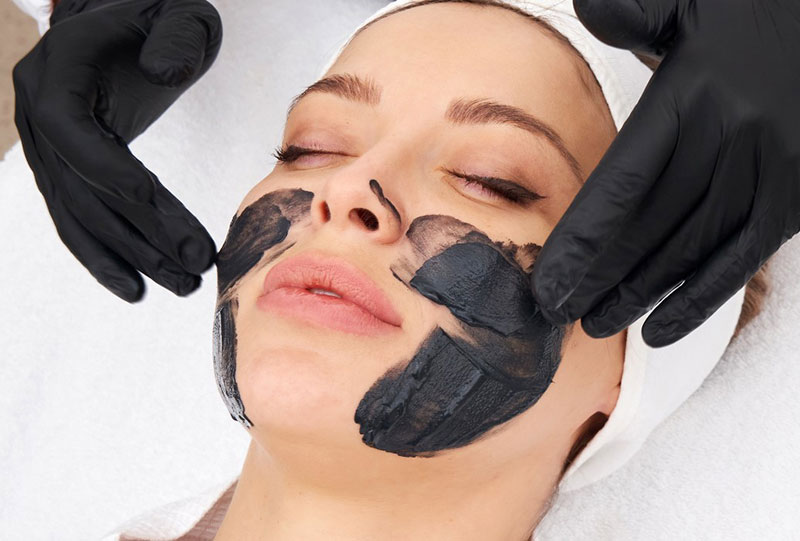 Peeling Carbón Activado Laser Carbon