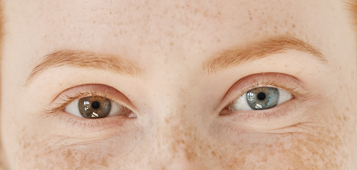 Cambio De Color De Ojos