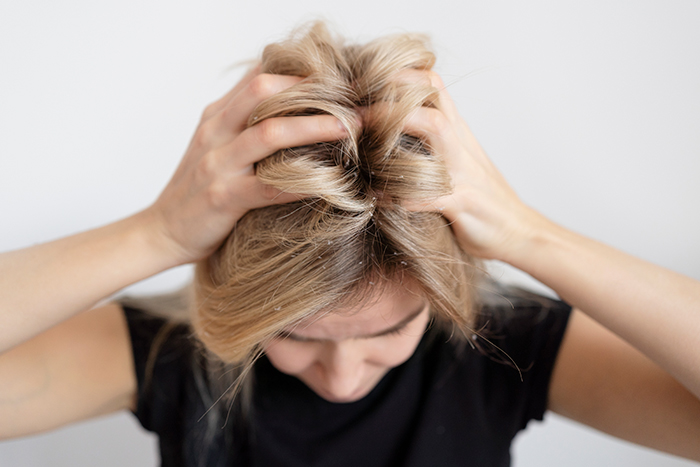 Acumulacion Cabello.png