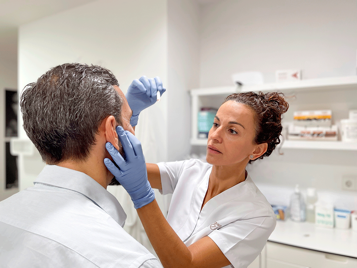 Labios Retoques Acido Hialuronico Dra. Cristina Núñez