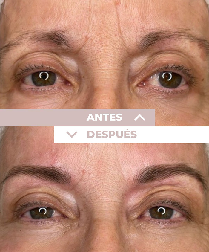 microblading-cejas-2