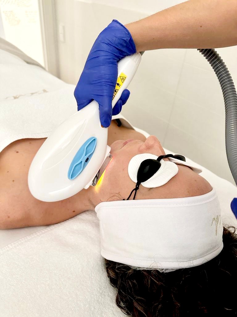 Blauceldona Barcelona. FHOS