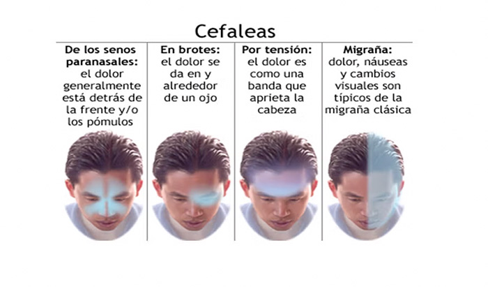 migraña-2