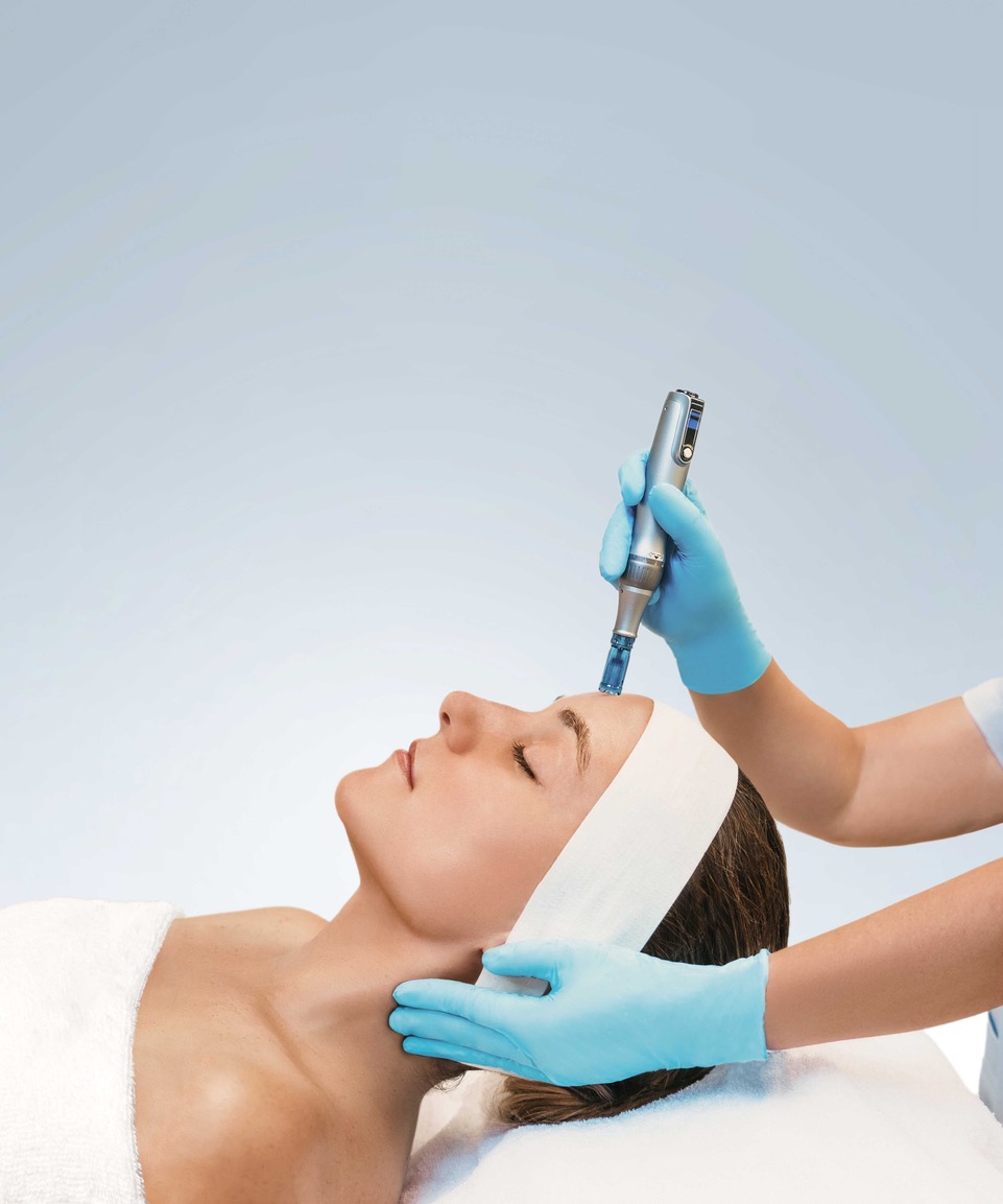 MONTIBELLO. SKINEXPERT ADVANCE Microneedling