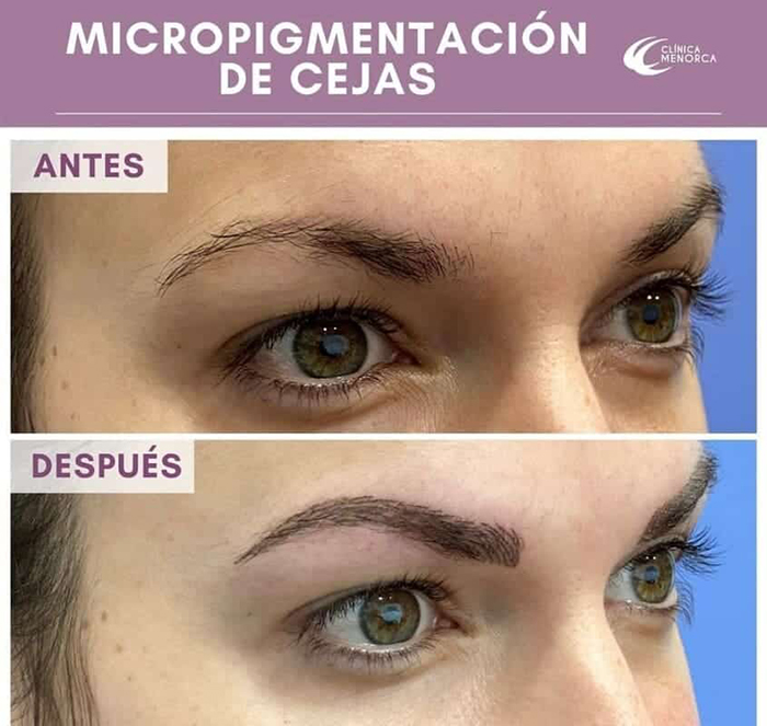 micropigmentacion-cejas-2