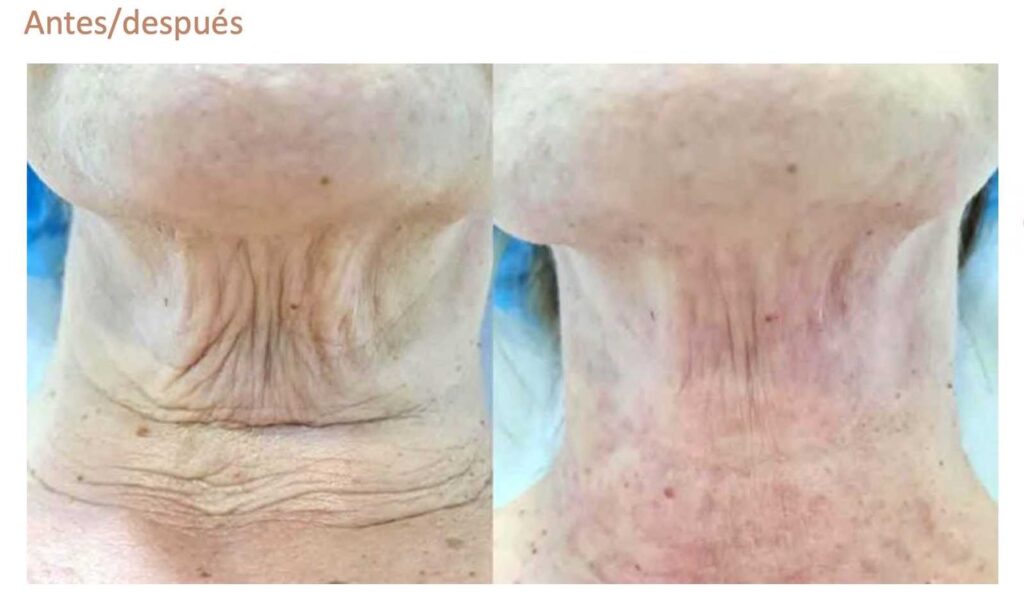 Tratamiento Facial | JOVENA