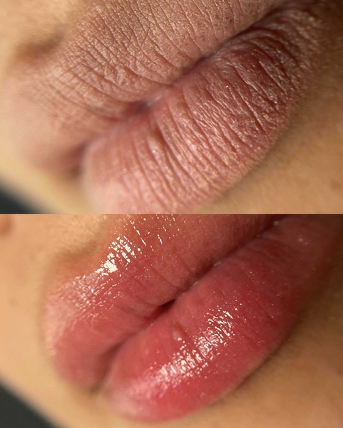 Labios.Carmen.Blanco