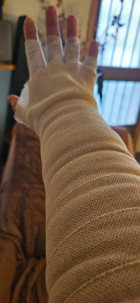 Vendaje Compresivo Multicapa Linfedema BellezaPura