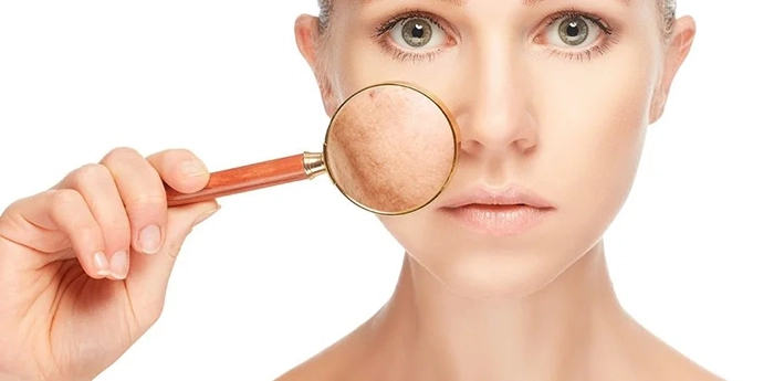 Lo último En Tratamiento Para Manchas En La Cara2 1 913x450.jpg